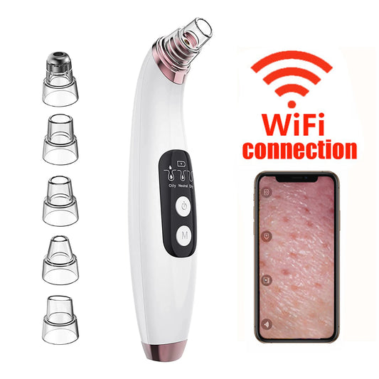 Blackhead Remover Pore Vacuum with Camera – Upgraded Face Cleanser with Wi‑Fi Visual, 3 Suction Levels & 5 Probes
