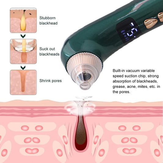 AOKO Blackhead Remover Pore Vacuum – Electric Deep-Cleaning Tool with Wi‑Fi Camera