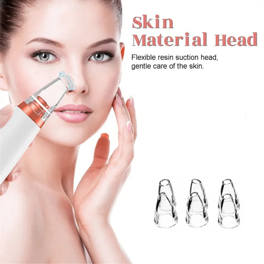Electric Vacuum Suction Blackhead Remover – USB Rechargeable Pore Cleaner & Acne Extractor